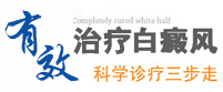 白癜风治疗方法
